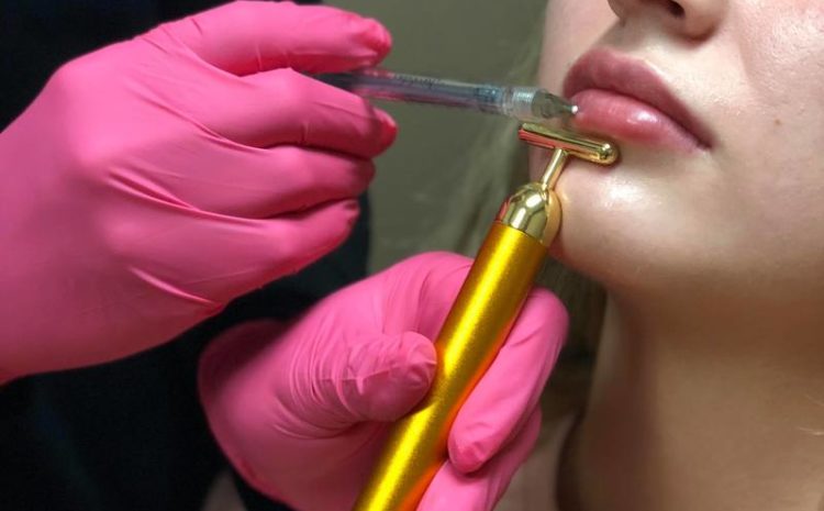 catalyst fargo are lip fillers safe