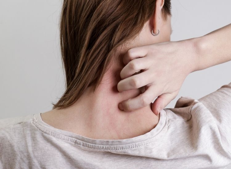 Catalyst-Dermatology-Eczema-Treatment