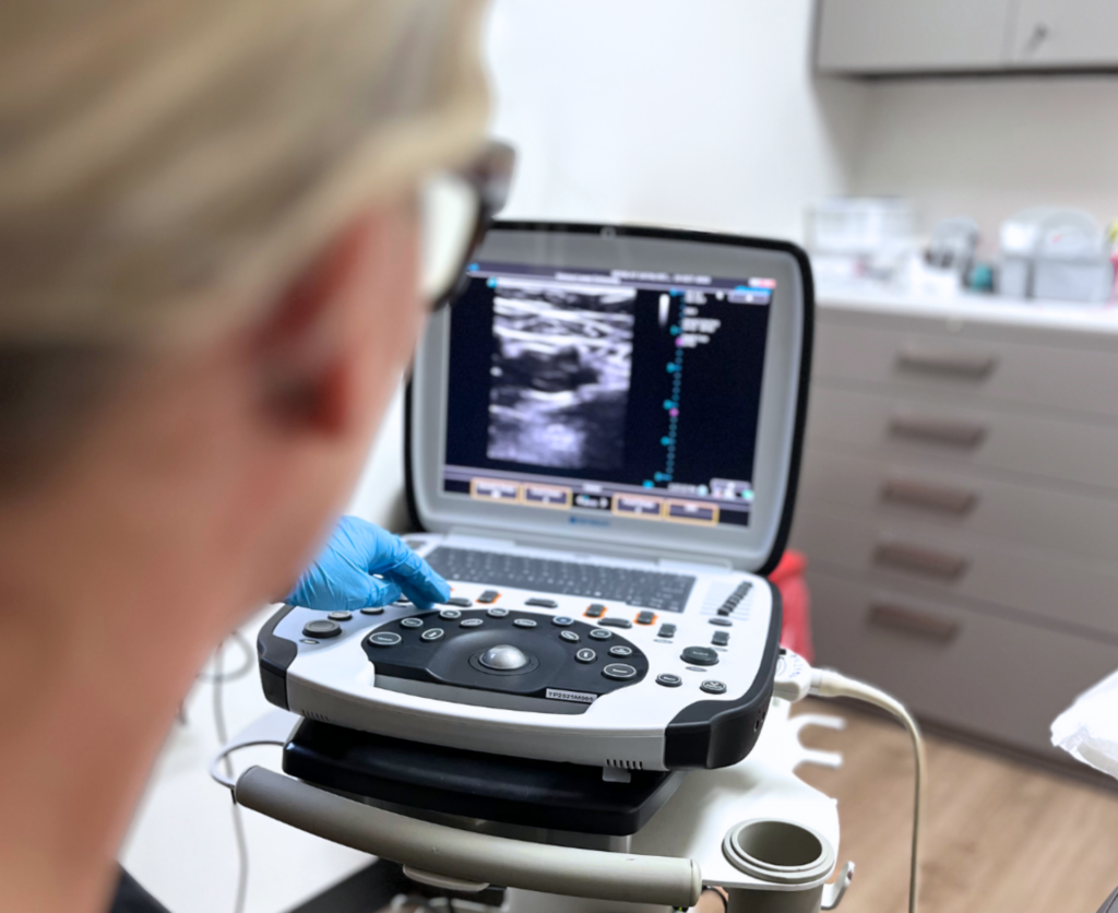 vein screening catalyst medical center in fargo